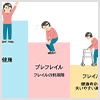 フレイルってなに？