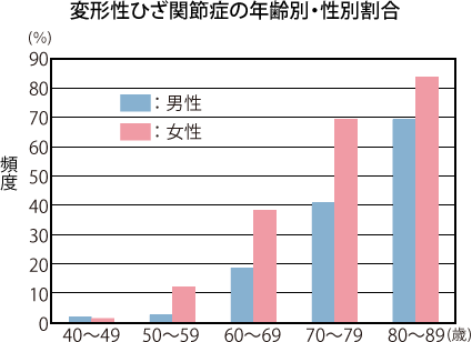 変形性ひざ関節症について ひざイキイキ 生化学工業株式会社