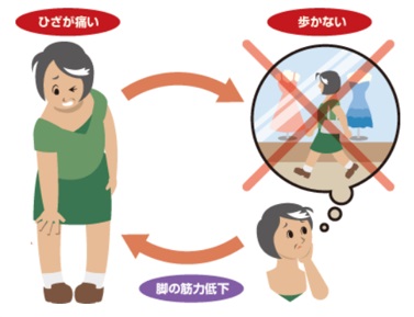 変形性膝関節症患者の日常生活における悪化サイクルのイラスト
