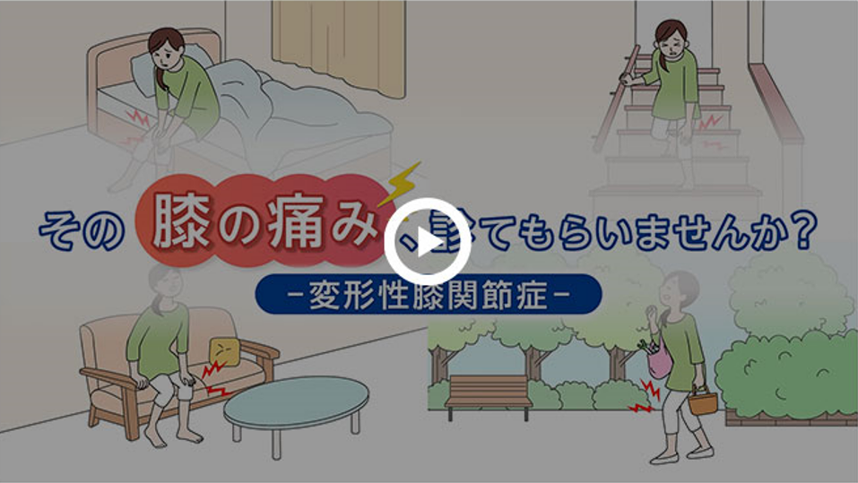 動画で解説する変形性膝関節症のバナー画像
